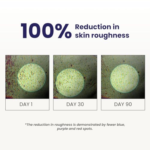 Image of RE' EQUIL 0.5% Retinol Night Cream | Makes Skin Youthful & Smooth | Prevents Fine Lines & Wrinkles | Unisex | All Skin Types | 32G