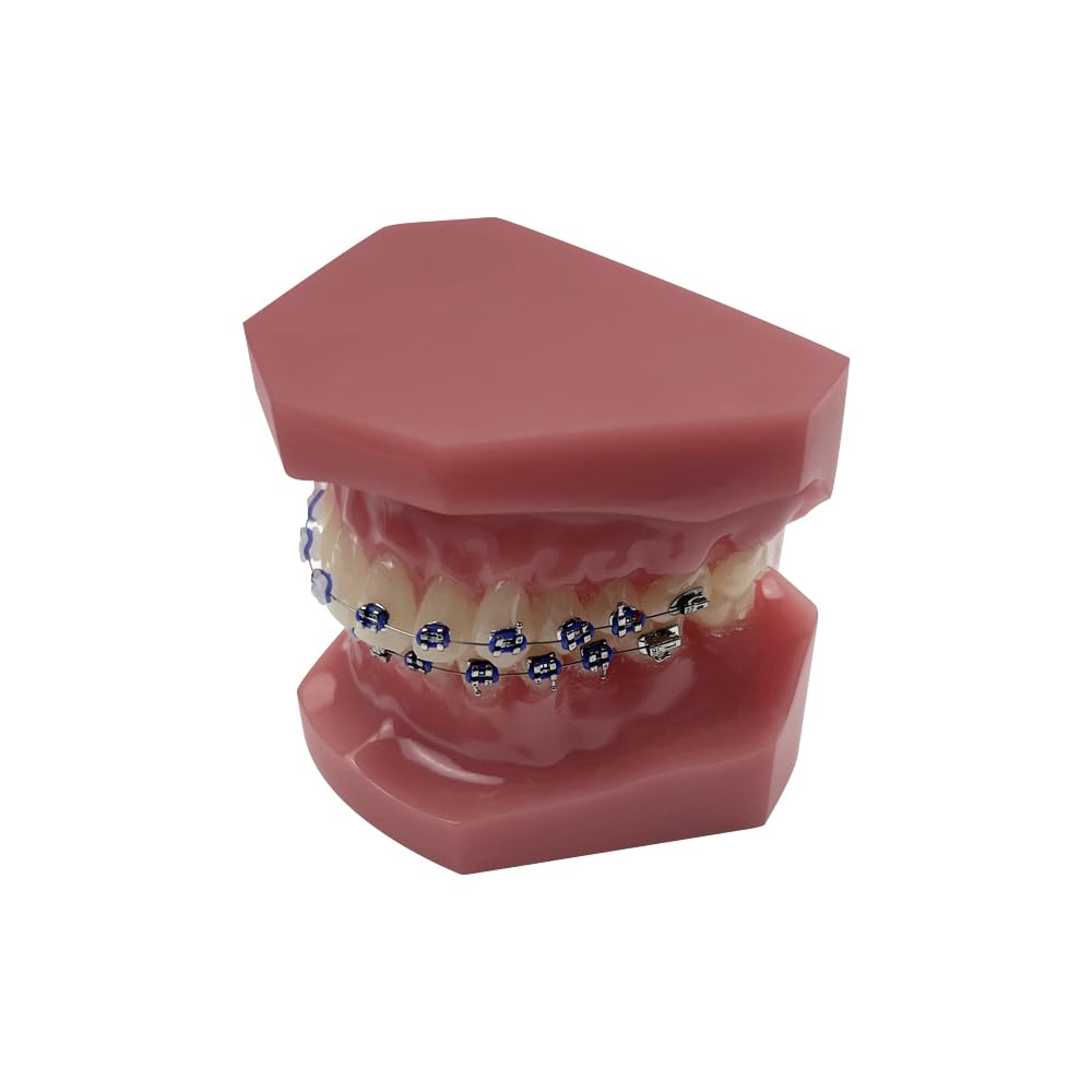 Orthodontisches Zahnmodell mit Halterungen, YOUYA DENTAL Demonstration Orthodontisches Modell für Bildung, Zähne Demonstration Typodonte Anatomisches Lehrwerkzeug mit Metall und Keramischer Halterung