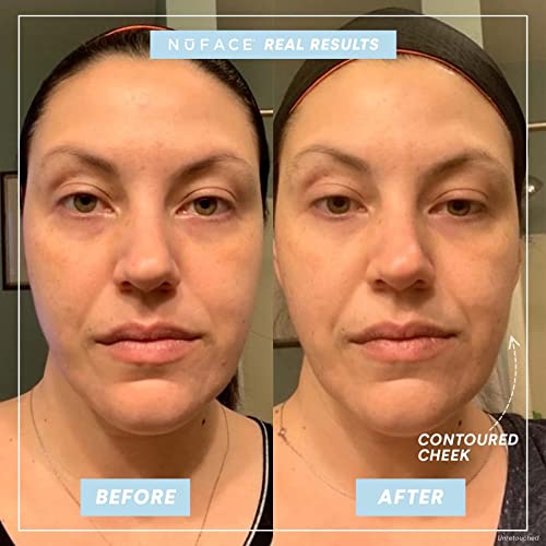 NuFACE Trinity Complete – Facial Toning Device with Hydrating Leave-On Gel Primer (2 Fl Oz), Effective Lip & Eye Attachment and Wrinkle Reducer Attachment