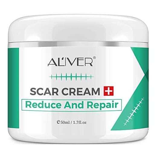 Scar Removal Cream For Old Scars, Stretch marks Scar Gel Treatment, Face Acne Scar Cream for Men and Women Remover Repair Skin Scar ,Surgical Scars, Burns on legs, arm -1.7 fl.oz
