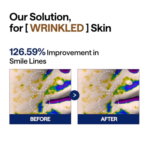 Image of MEDIHEAL Toner Pads - Retinol Collagen Lifting Pad (100 counts) for Skin Rejuvenation & Firming - Lifting Pads for Enhancing Skin Texture - Vegan Stretchable Lifting Fabric, Korean Skin Care