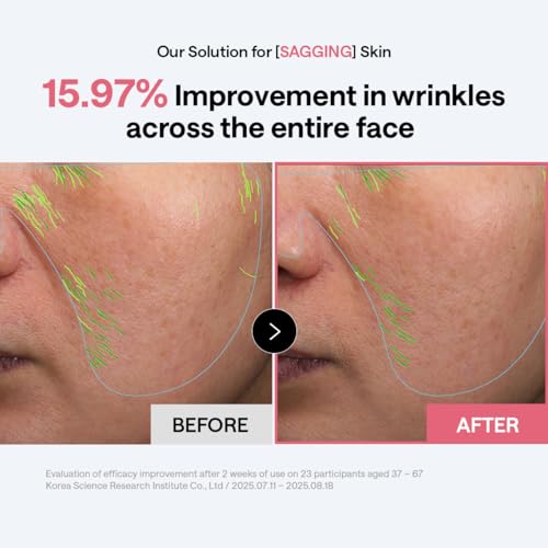 Image of MEDIHEAL Collagen Toner Pads, Skin Firming Korean Facial Pads with 98% Low-Molecular Collagen, Peptides & Retinol, Helps Restore Skin Elasticity, Removes Wrinkles & Fine Lines, Hydrating Daily Toner, Vegan (100 Count, 170ml)