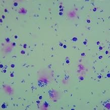 1 Piece Toxoplasma Gondii Trophozoites W.M Parasitology Parasite Prepared Slides