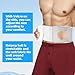 Ostomy Support Belt, Adjustable Stoma Support Belt Medical Ostomy Hernia Belt, Universal Ostomy Belt, Abdominal Ostomy Hernia Binder Supplies, Ileostomy Belt Helps Protection Ostomy Bag(Gray,L)