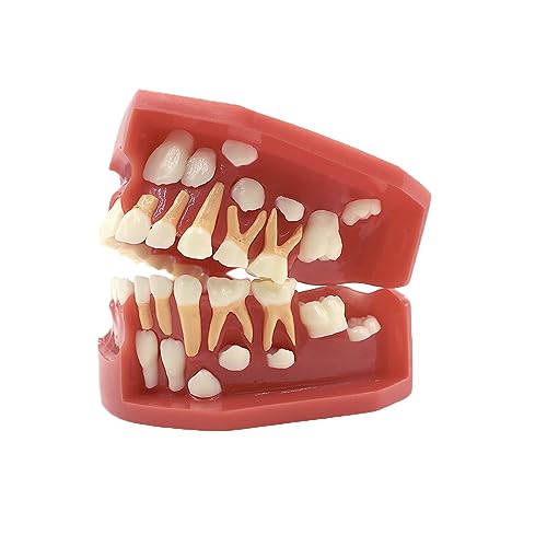 RUCYAI - RUCYAI Pediatric Dental Education Model, 6-9 Years Old, Silicone, 1 Piece, Mixed Dentition Brushing Education, Dental Training