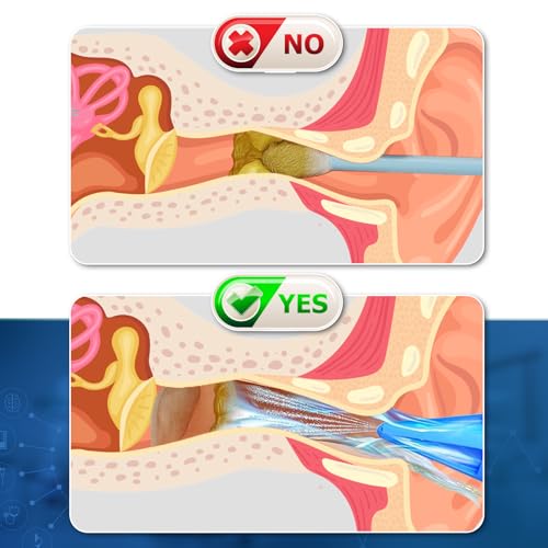 image for Healov Ear Wax Removal Syringe – Water Irrigation Ear Cleaner Ear Wa