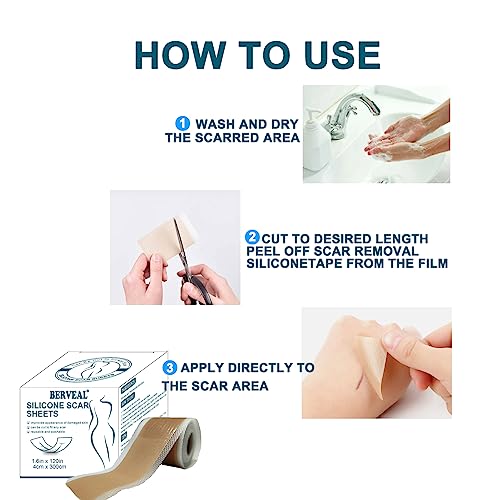 Silicone Scar Tape Roll, Silicone Scar Sheets, Scar Silicone Strips (1.6” X120”Inch - 3M), Easy-Tear Gel Tape For Scar, Soft Silicone Scar For Surgery Scars, Medical Grade Wound Dressing #TOP6