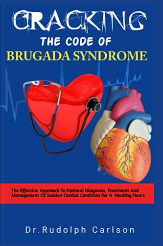 CRACKING THE CODE OF BRUGADA SYNDROME: The Effective Approach To Optimal Diagnosis, Treatment And Management Of Sudden Cardiac Condition For A Healthy Heart (Healthy Heart Chronicle)