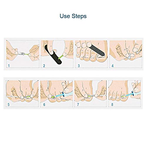 7pcs pedicure incarniti set di strumenti per
