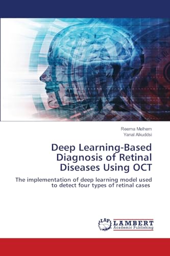 Deep learning diagnosis of retinal diseases OCT : modèle de détection des pathologies de la rétine