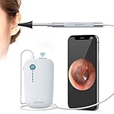 ✅This wireless otoscope comes with removable tips ear removal tool and specula that can be cleaned after use so you can use it on the whole family.