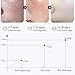 Dark Spot Remover for Face,Nicotinamide Whitening Anti-Freckle Cream,Skin Dullness Lightening Body Cream,Visible Results in 28 Days,Smooth Melasma,Hyperpigmentation Age Dark Spot Corrector,0.7 oz