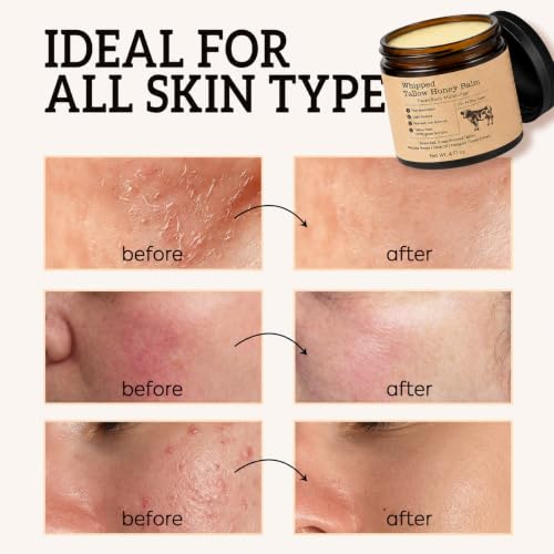 Image of Beef Tallow for Skin: Organic Grass-Fed Tallow Face Cream with Manuka Honey, Olive Oil, Jojoba Oil & Vitamin E, Non-Greasy Face and Body Moisturizer, 4 oz