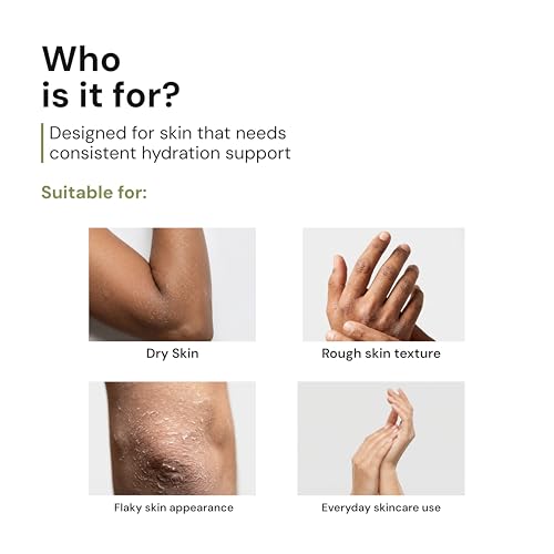 Image of Parasoft Moisturizing Cream with Aloe Vera - 500g (Pack of 8) | Deep Hydration Intense Moisturizer for Dry & Dehydrated Skin, Non-Greasy, All-Season Daily Skincare, Dermatologist Tested, Paraben-Free