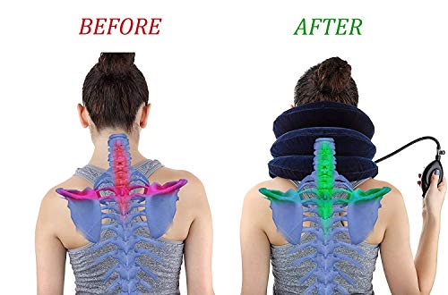 cervical neck traction device inflatable neck stretcher easy to use for chronic neck and shoulder pain relief traction spine alignment neck cervical brace