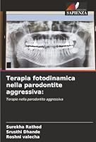 Terapia fotodinamica nella parodontite aggressiva 6209314635 Book Cover