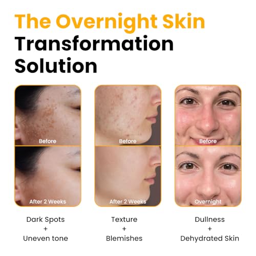 QUIA Turmeric + Kojic Acid Overnight Wrapping Mask – Hydration Mask for Glowing Skin – Evens Tone, Soothes Redness and Improves Skin Texture – Korean Skincare 75ML - Image 4