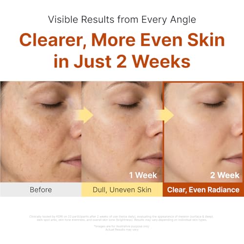 Image of SUNGBOON EDITOR Glow Intensive Kojic Acid Ampoule, Radiance-Boosting Serum for Face with Kojic Acid, Turmeric & PHA, For Uneven Skin Tone & Dark Spot Care, Korean Skincare Serum, 1.35 fl oz