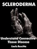 Scleroderma - Understand Connective Tissue Disease