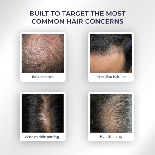 Image of Conscious Chemist Full Strength Anti-Hairfall Rosemary Spray | Post Wash Spray with Rosemary Extract, Yeast Extract & Copper Tripeptide-1 | Reduces Hairfall & Softens Strands | StrandBoost️ Technology | For All Hair Types | Women & Men | 200ml (Pack of 2)