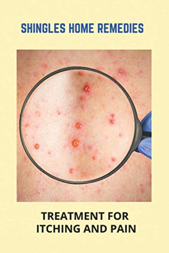 Shingles Home Remedies: Treatment For Itching And Pain: Shingles Recovery