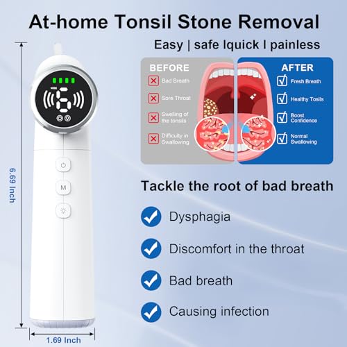 Rechargeable Tonsil Stone Vacuum
