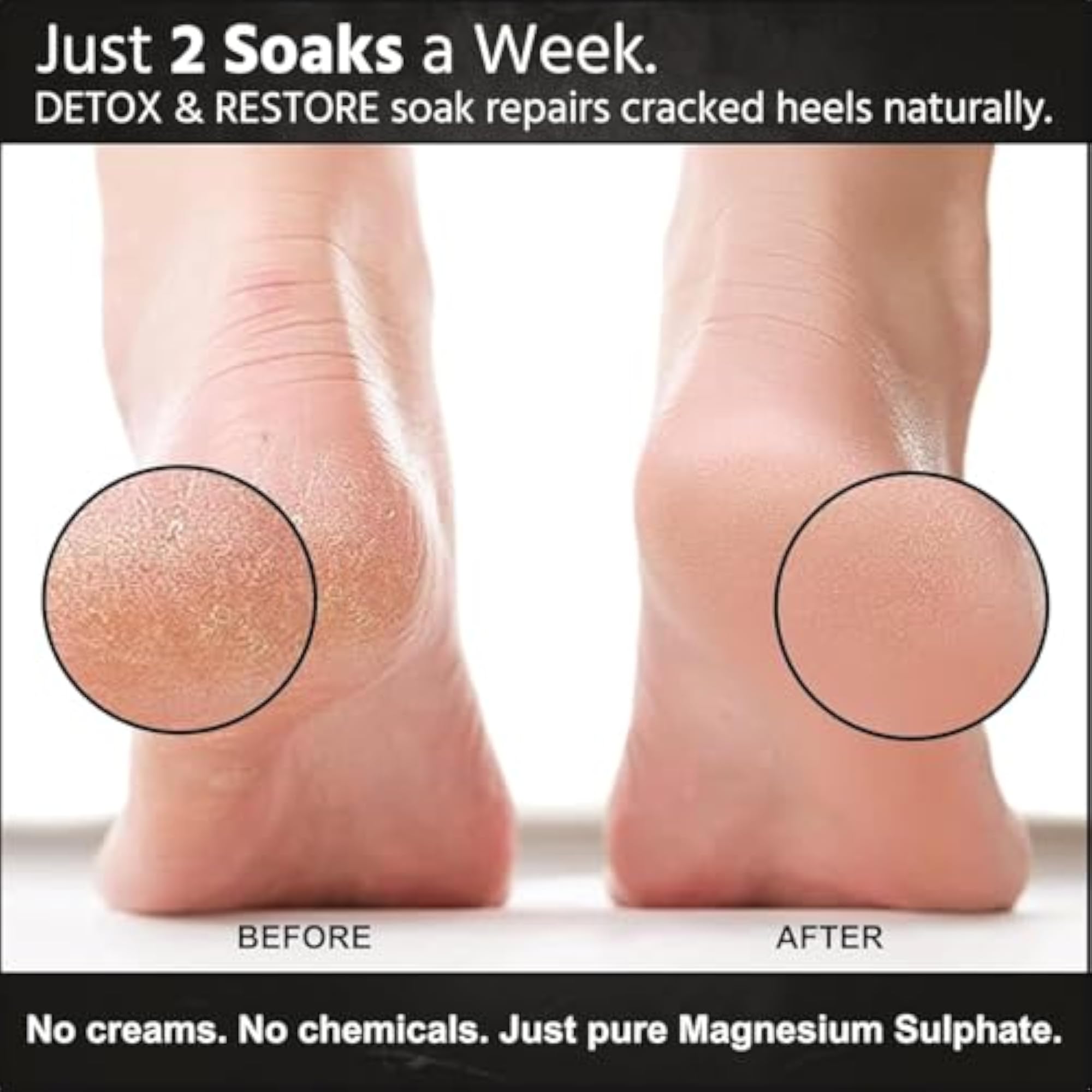 SNAPLYST Epsom Salt for Relaxing Bath and Foot Soak