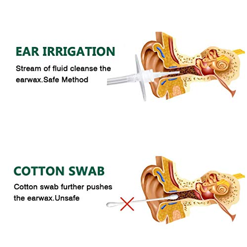 Ear Wax Remover OOCOME Ear Washer Bottle Ear Cleaning for Adults and Kids Ear Cleaner Ear Wax Removal Tool Kit with 1 Cleaning Brush, 1 Ear Basin, 1 Bulb Cleaner, 5 Disposable Tips