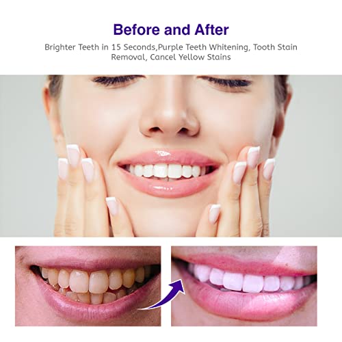 Nolipem NOLIPEM-1KU54 Purple Teeth Whitening thumb #6