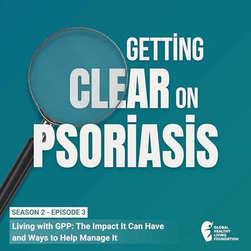 Living with GPP: The Impact It Can Have and Ways to Help Manage It cover art