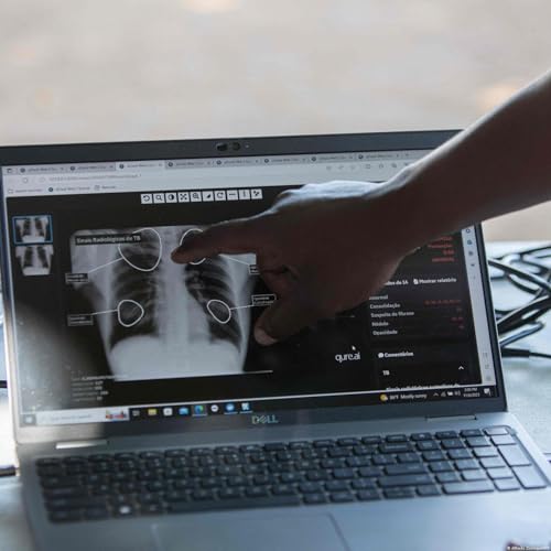 Informer pour changer le regard sur la tuberculose