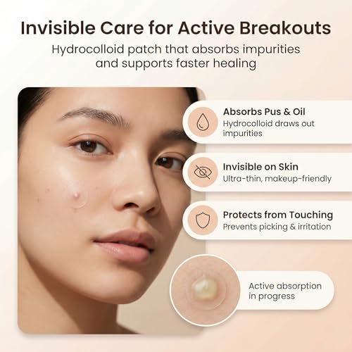 Image of Hydrocolloid Roll for Wound Care - Medical-Grade Adhesive Wound Dressing Roll 2 in x 16 ft - 0.5 mm Thickness - Cut-to-Size Hydrocolloid Bandage Material for Healing Blisters, Cuts & Scrapes