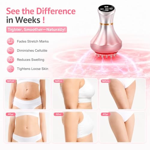 Image of 4-in-1 Lymphatic Drainage Massager - Anti-Cellulite Message Tool with Heating /Vibration /Light Therapy, Cordless Handheld for Sciatica, Full Body Pain Relief & Skin Tightening