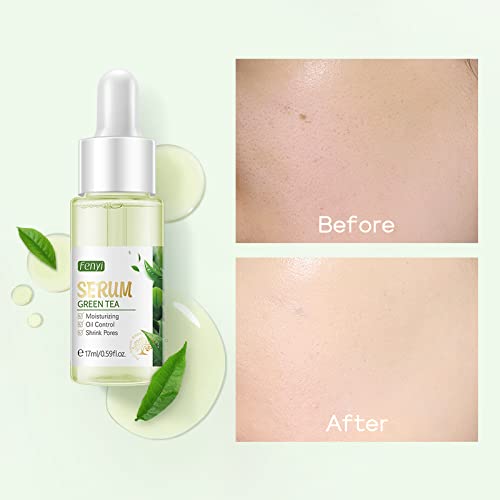 Akary Green Tea Face Serum Moisturizing & Hyaluronic Acid Oil Control Skin Soothing Skincare Shrink Pores Serum, Natural Facial Serum For Skin Care Breakout Pimple Cutin Repair #TOP4