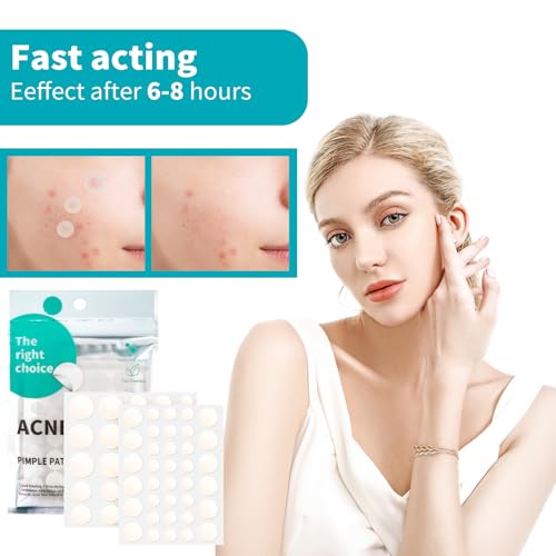 Pimple Patches 528 pièces, Hydrocolloïde Acné Patch, Invisible Naturel Patch Bouton, Utilisation de Jour et de Nuit, 2 en 1, Avec Huile De Tea Tree Et Acide Salicylique 4 tailles (8/10/13/15 mm) – vue 2