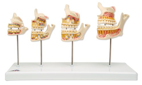 Image of 3B Scientific D20 Dentition Development Model, 13.0 inch x 3.9 inch x 7.9 inch