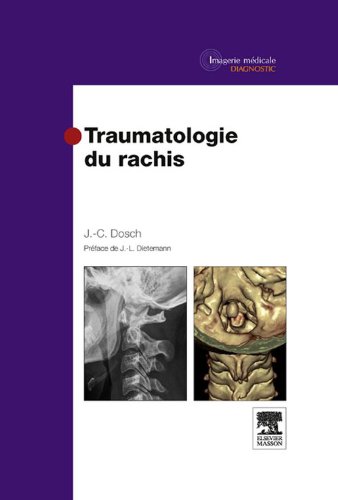 Télécharger Traumatologie du rachis (Imagerie médicale : diagnostic) Livre eBook France