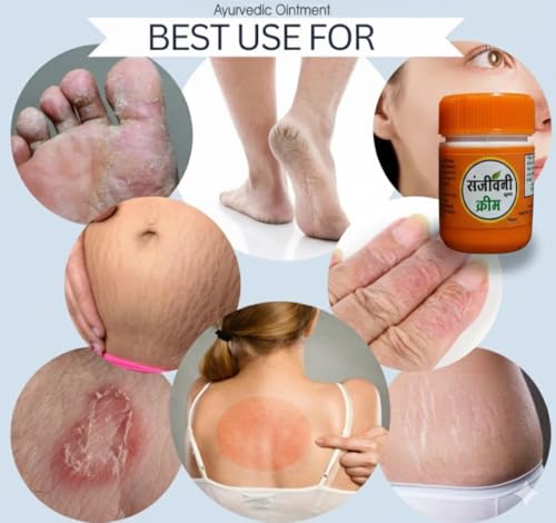 Image of Super Eczema Fungal Cream For Men & Women Ayurvedic ItchCoat Anti Fungal Malam For Ringworm itching Eczema (Sanjivanii Fungal Cream, 15gm pack of 2)