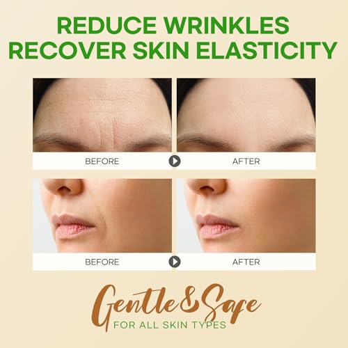 Image of SILKDERMIS Forehead Wrinkle Patches 12Pcs, Smile Line Patches 24pcs with Aloe, Collagen, Vitamin E, Anti Wrinkle Patches, Anti Wrinkle Patches