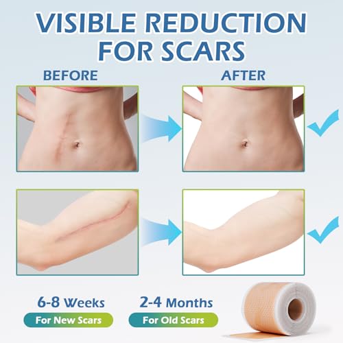 Ptlihu Silicone Scar Sheets thumb #3