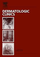 Photodynamic Therapy, an Issue of Dermatologic Clinics: Volume 25-1 1416043047 Book Cover