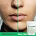 Neem Facial Wax Powder - 100Gram (3.52 Ounce) - 5 min Painless Herbal Hair Removal Waxing Powder | No Irritation, No Skin rashes,Gentle Effective, 1Pack