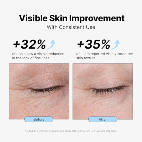 Image of EnaSkin Retinol Collagen Face Cream for Wrinkles, Anti-Aging Moisturizer