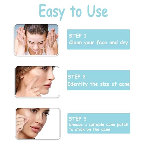 Pimple Patch Rnitle – 180 Stück Pickelpatches für Aknebehandlung