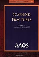 Scaphoid Fractures (Monograph Series (American Academy of Orthopaedic Surgeons)) 0892034513 Book Cover