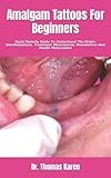  Amalgam Tattoos For Beginners: Quick Remedy Guide To Understand The Origin, Manifestations, Treatment Alternatives, Preventions And Health Restoration