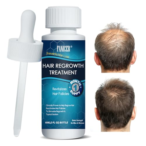 #rémunéré #Amazon<br>60ML Serum Croissance des Cheveux Stimule la Pousse Soin Cheveux Pour Adulte Clairsemes