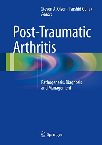 Post-Traumatic Arthritis view 2