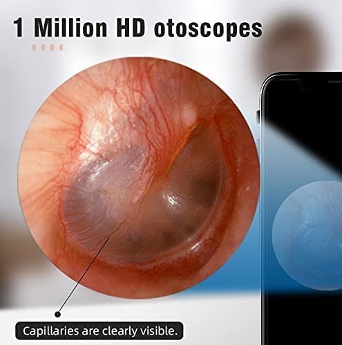Removedor de Cera for el oído, Herramienta de eliminación inalámbrica Otoscope EARTWAX 108 0p HD Endoscopio de la Oreja con 6 LED Luz, oído Elija un oído Limpieza endocsope Kit for Adultos niños