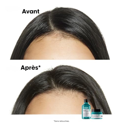 Shampooing Purifiant Cheveux Gras Scalp Advanced 'oréal Professionnel 300ml - vue 8